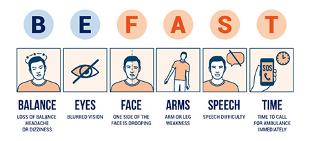 Symptoms of stroke